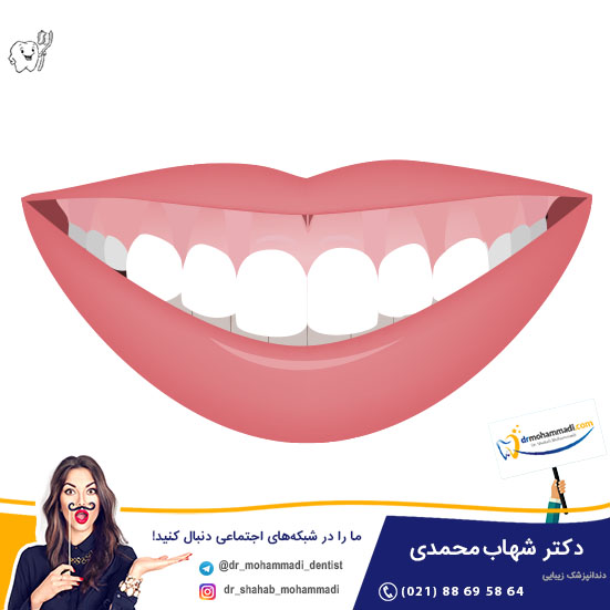 فیلم جراحی لبخند لثه ای - کلینیک دندانپزشکی دکتر شهاب محمدی